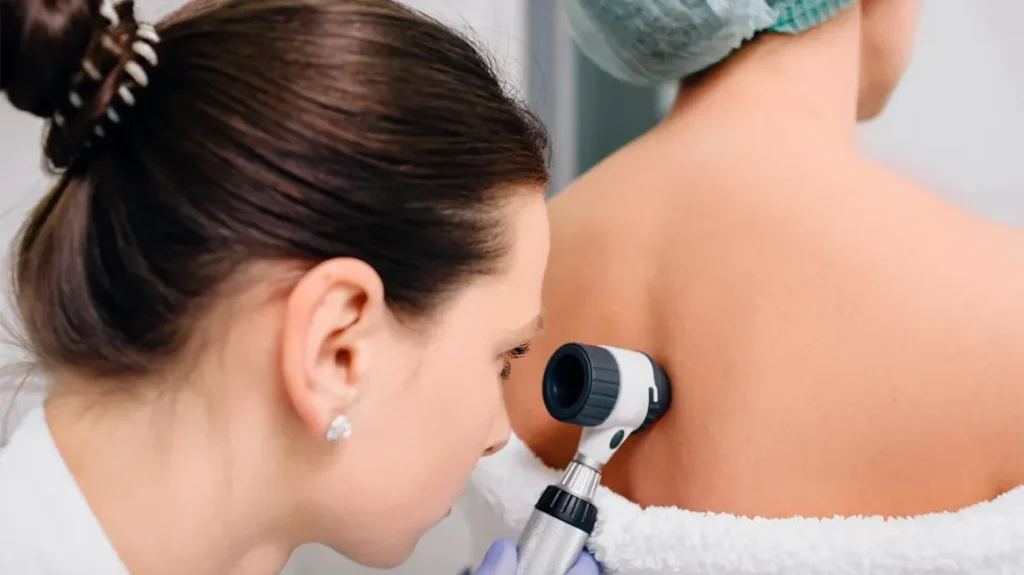 dermatologist